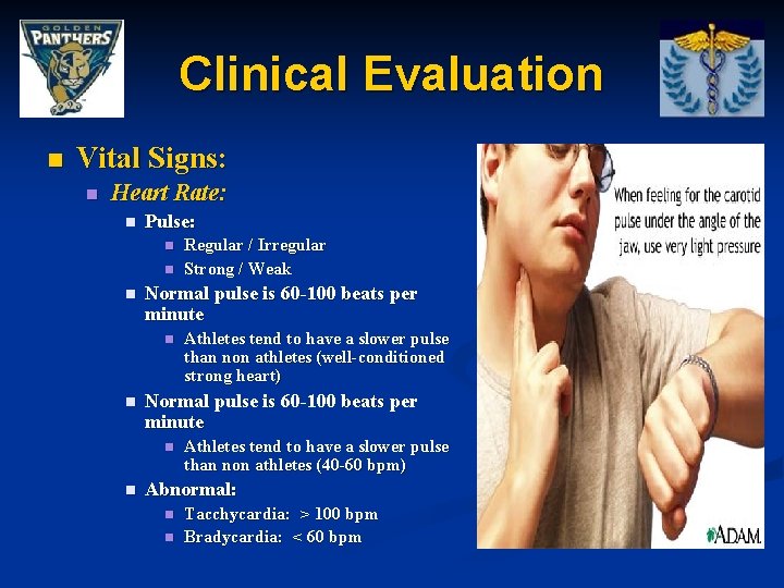 Clinical Evaluation n Vital Signs: n Heart Rate: n Pulse: n n n Normal