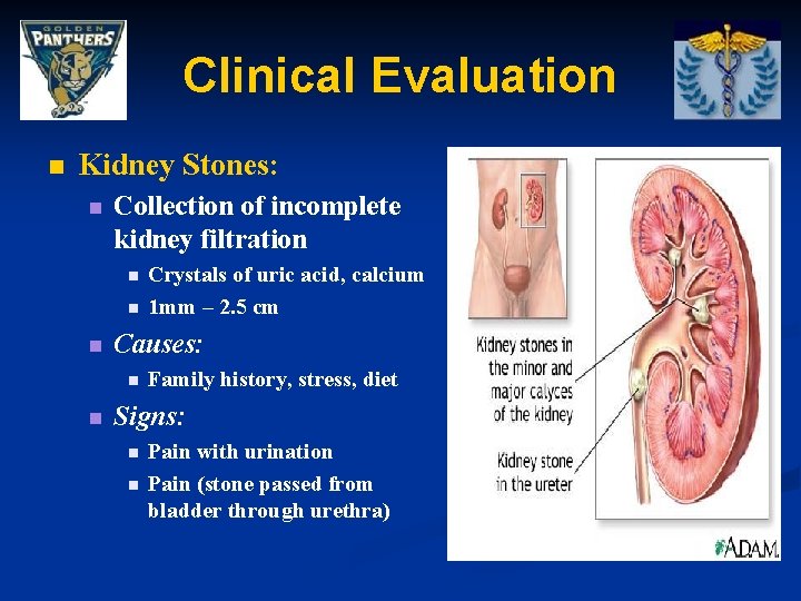 Clinical Evaluation n Kidney Stones: n Collection of incomplete kidney filtration n Causes: n