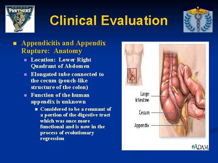 Clinical Evaluation n Appendicitis and Appendix Rupture: Anatomy n n n Location: Lower Right
