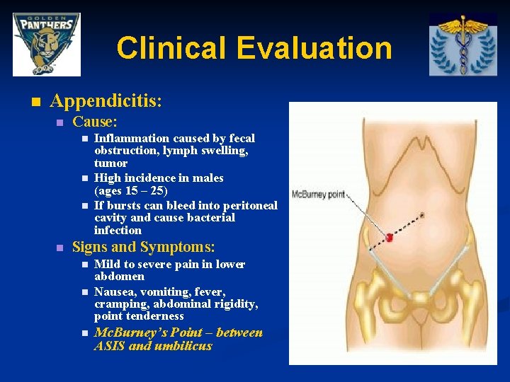 Clinical Evaluation n Appendicitis: n Cause: n n Inflammation caused by fecal obstruction, lymph