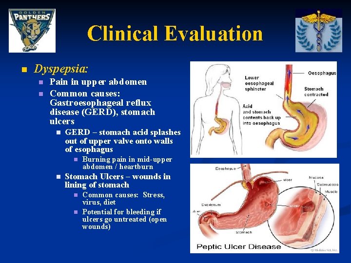 Clinical Evaluation n Dyspepsia: n n Pain in upper abdomen Common causes: Gastroesophageal reflux