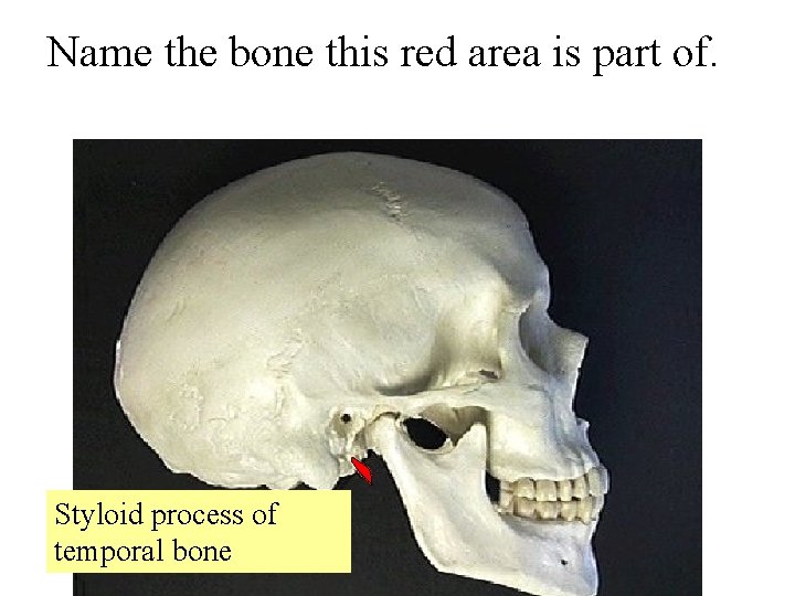 Name the bone this red area is part of. Styloid process of temporal bone
