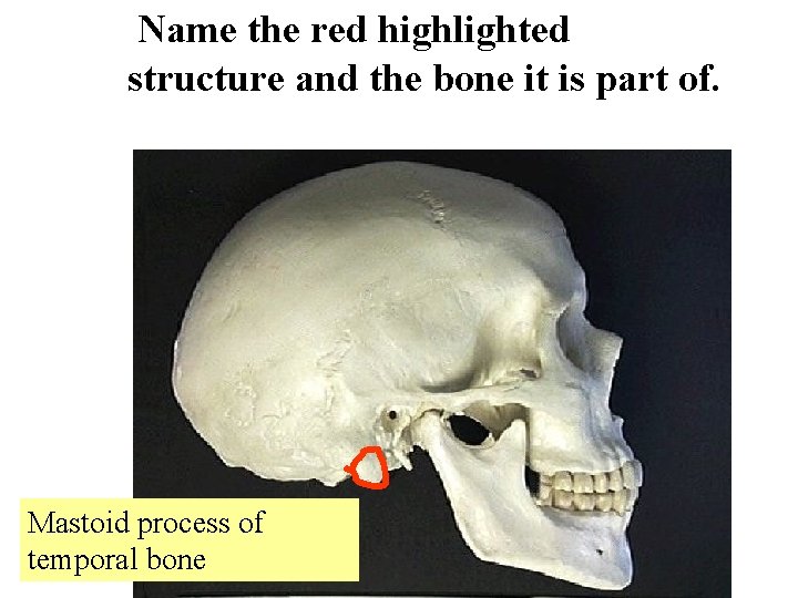 Name the red highlighted structure and the bone it is part of. Mastoid process