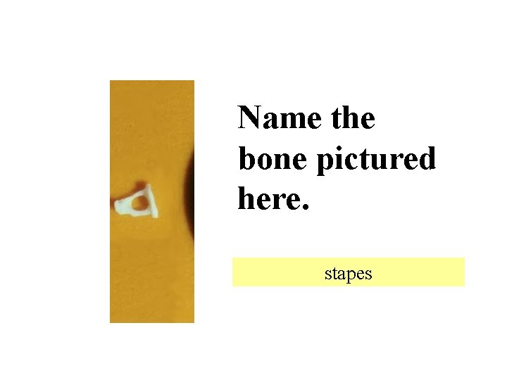 Name the bone pictured here. stapes 