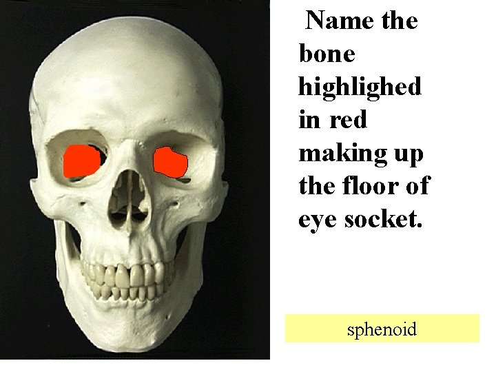 Name the bone highlighed in red making up the floor of eye socket. sphenoid