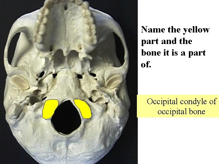 Name the yellow part and the bone it is a part of. Occipital condyle