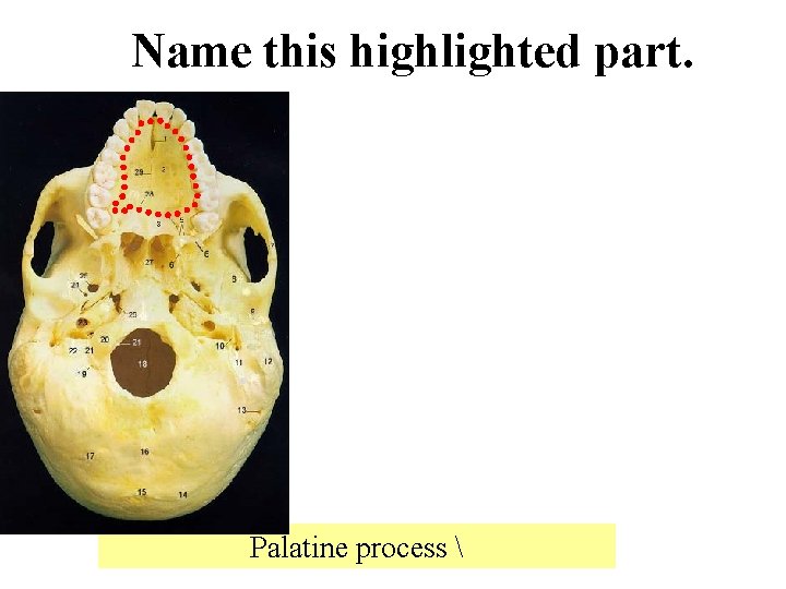 Name this highlighted part. Palatine process  