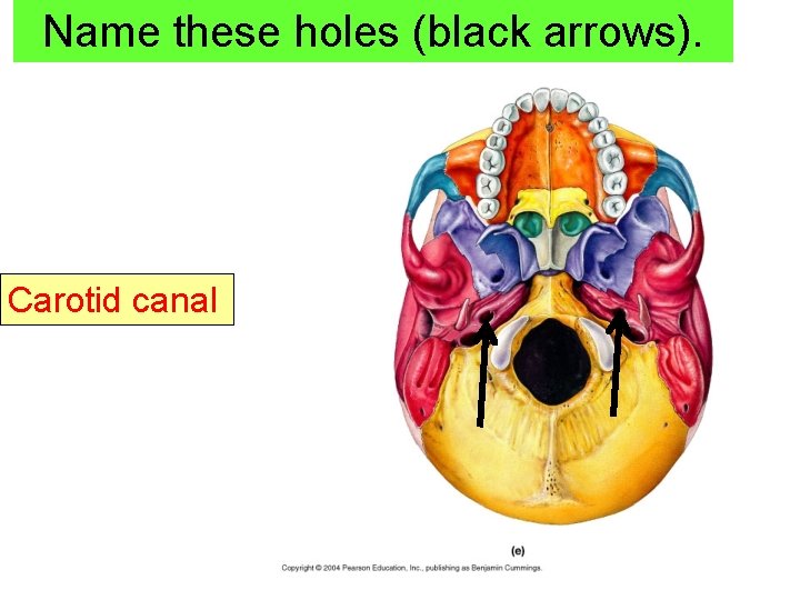 Name these holes (black arrows). Carotid canal 