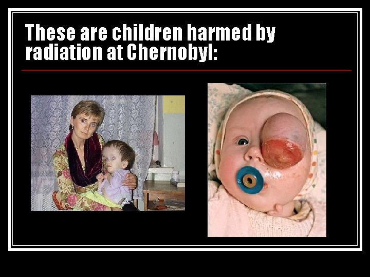 These are children harmed by radiation at Chernobyl: 