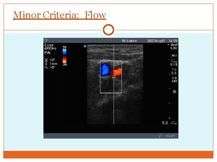 Minor Criteria: Flow 