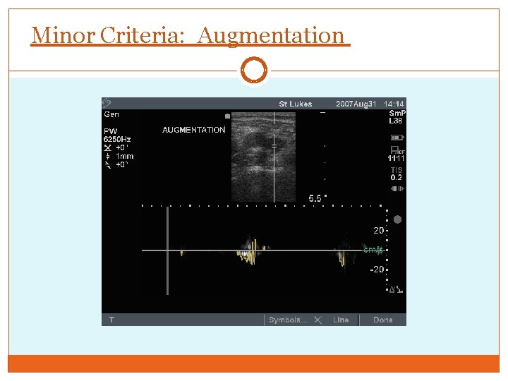 Minor Criteria: Augmentation 