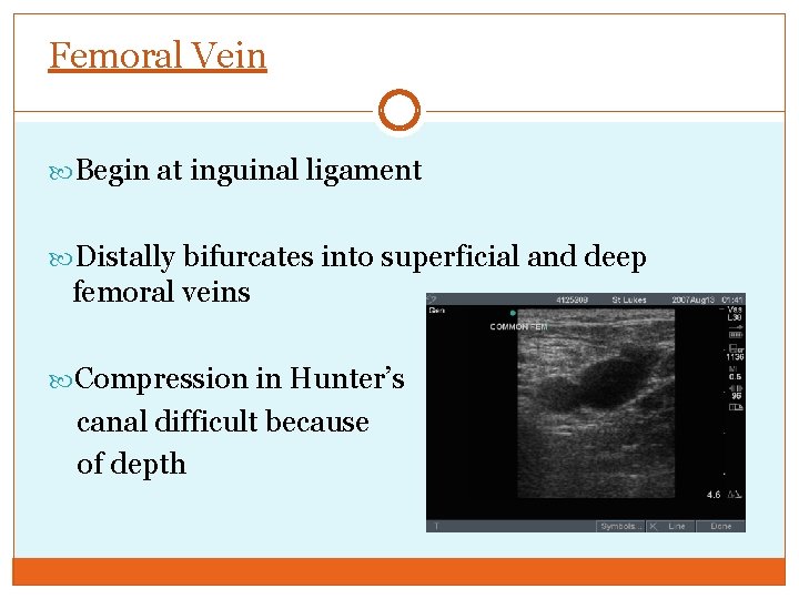 Femoral Vein Begin at inguinal ligament Distally bifurcates into superficial and deep femoral veins