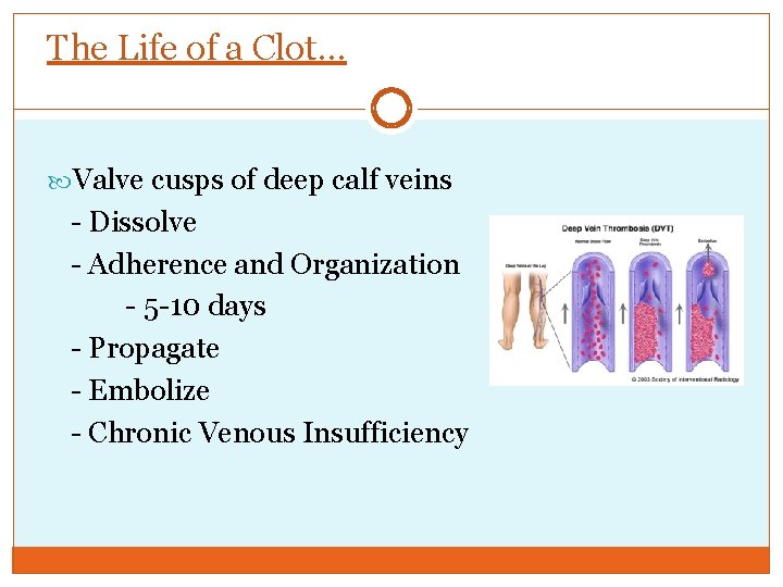 The Life of a Clot… Valve cusps of deep calf veins - Dissolve -