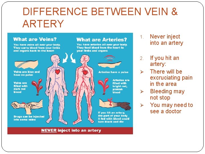 DIFFERENCE BETWEEN VEIN & ARTERY 1. Never inject into an artery 2. If you