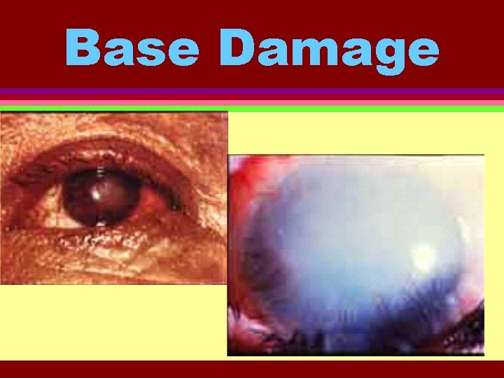 Base Damage 