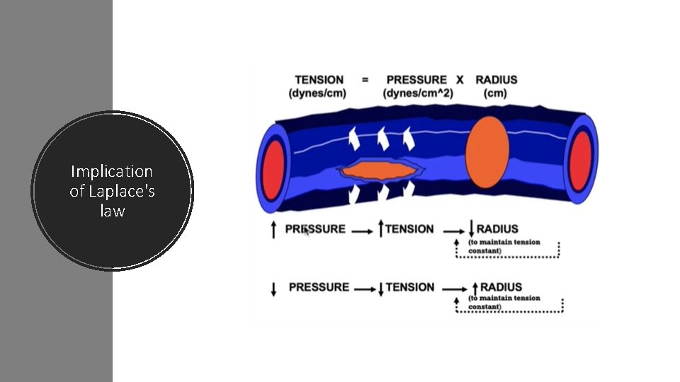 Implication of Laplace's law 