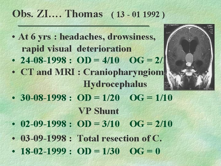 Obs. ZI…. Thomas ( 13 - 01 1992 ) • At 6 yrs :