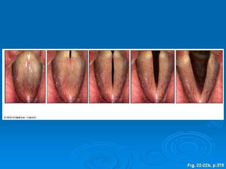 glottis closed glottis open Fig. 22 -22 b, p. 375 