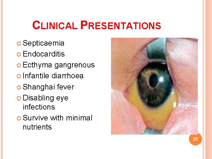 CLINICAL PRESENTATIONS Septicaemia Endocarditis Ecthyma gangrenous Infantile diarrhoea Shanghai fever Disabling eye infections Survive