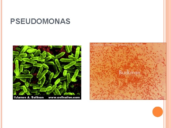 PSEUDOMONAS 