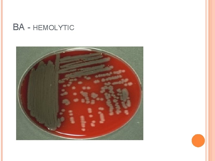 BA - HEMOLYTIC 