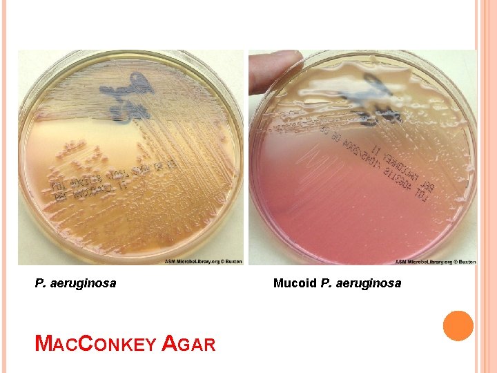 P. aeruginosa MACCONKEY AGAR Mucoid P. aeruginosa 