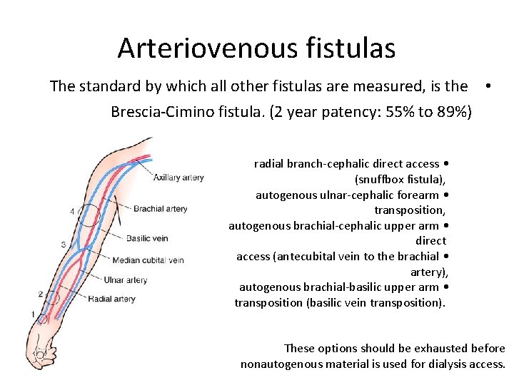 Arteriovenous fistulas The standard by which all other fistulas are measured, is the •