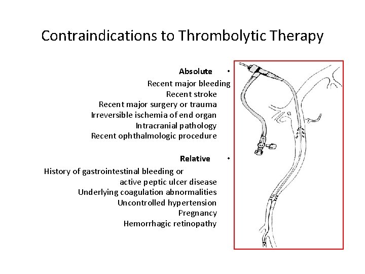 Contraindications to Thrombolytic Therapy Absolute • Recent major bleeding Recent stroke Recent major surgery