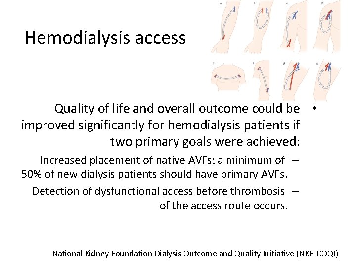 Hemodialysis access Quality of life and overall outcome could be • improved significantly for