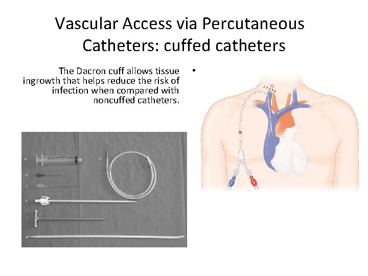 Vascular Access via Percutaneous Catheters: cuffed catheters The Dacron cuff allows tissue ingrowth that