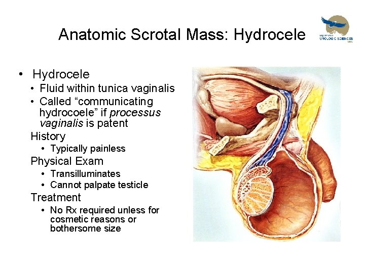 Anatomic Scrotal Mass: Hydrocele • Fluid within tunica vaginalis • Called “communicating hydrocoele” if