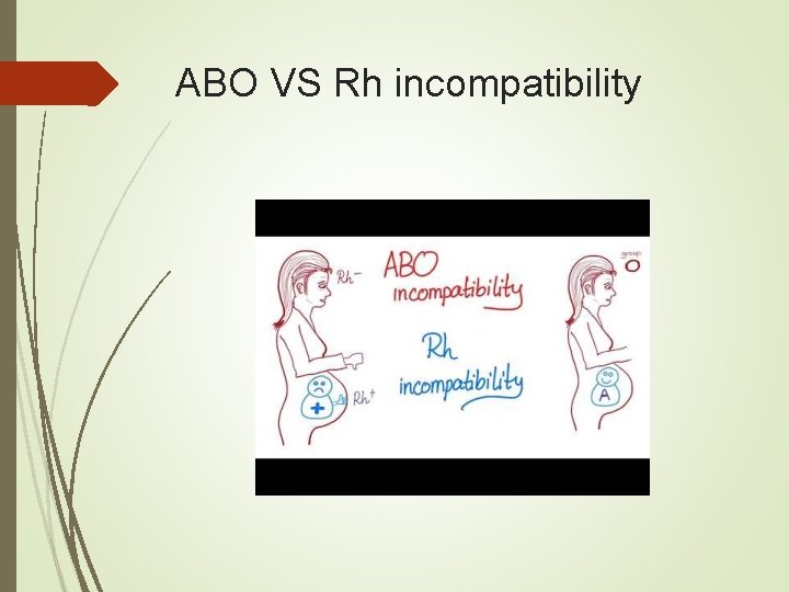 ABO VS Rh incompatibility 