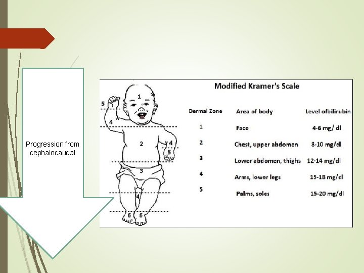 Progression from cephalocaudal 