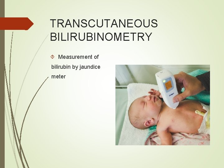 TRANSCUTANEOUS BILIRUBINOMETRY Measurement of bilirubin by jaundice meter 