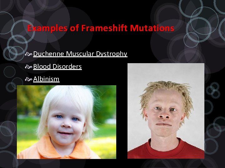 Examples of Frameshift Mutations Duchenne Muscular Dystrophy Blood Disorders Albinism 