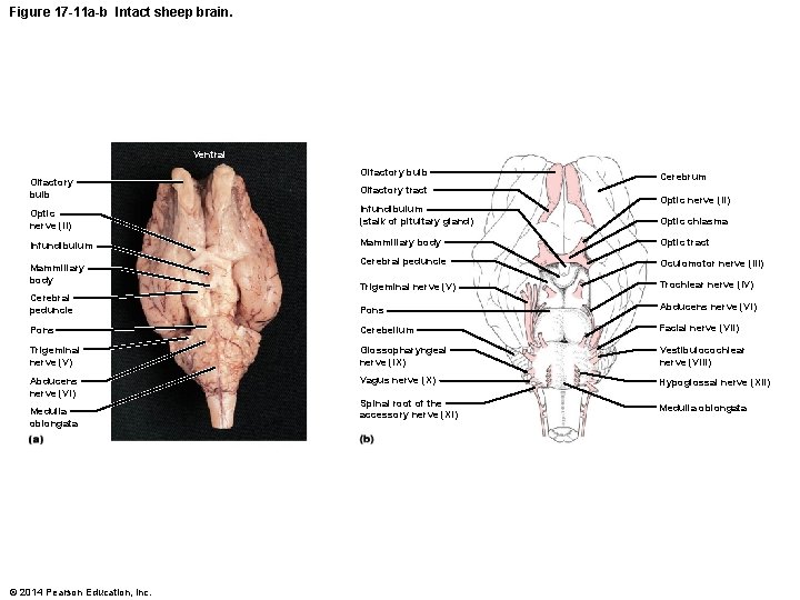 Figure 17 -11 a-b Intact sheep brain. Ventral Olfactory bulb Cerebrum Olfactory bulb Olfactory