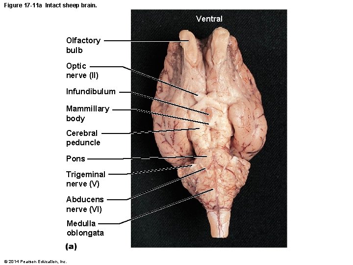 Figure 17 -11 a Intact sheep brain. Ventral Olfactory bulb Optic nerve (II) Infundibulum