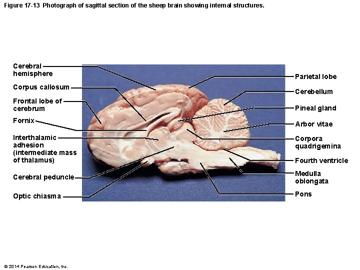 Figure 17 -13 Photograph of sagittal section of the sheep brain showing internal structures.