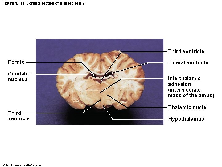 Figure 17 -14 Coronal section of a sheep brain. Third ventricle Fornix Caudate nucleus