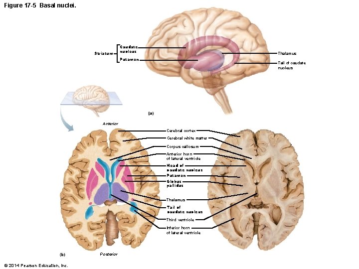 Figure 17 -5 Basal nuclei. Striatum Caudate nucleus Thalamus Putamen Tail of caudate nucleus