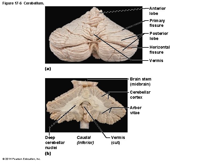 Figure 17 -6 Cerebellum. Anterior lobe Primary fissure Posterior lobe Horizontal fissure Vermis Brain