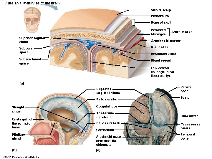 Figure 17 -7 Meninges of the brain. Skin of scalp Periosteum Bone of skull