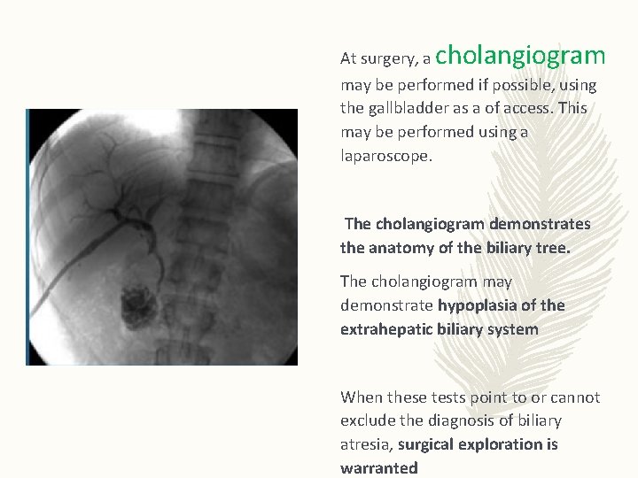 At surgery, a cholangiogram may be performed if possible, using the gallbladder as a