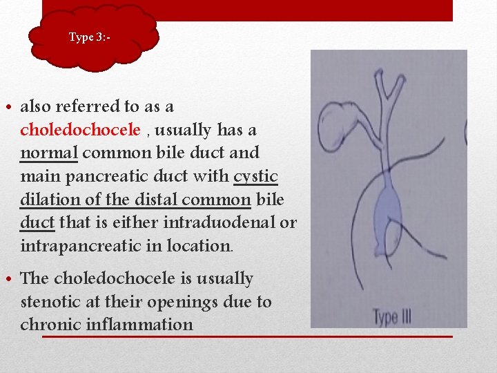 Type 3: - • also referred to as a choledochocele , usually has a