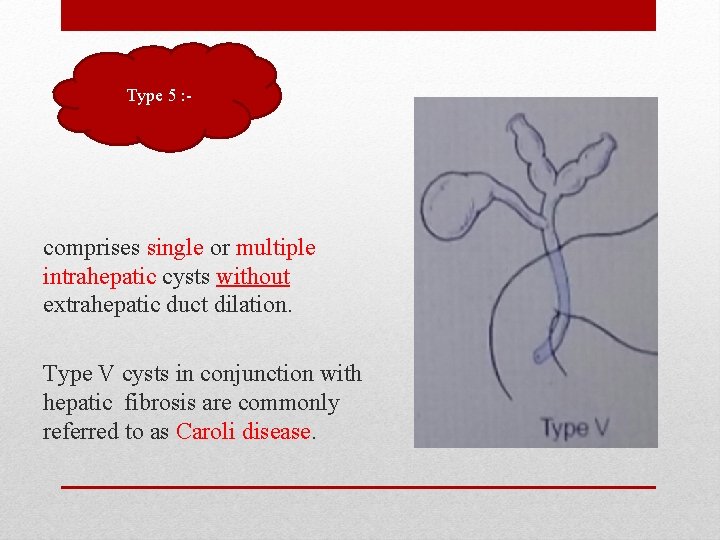 Type 5 : - comprises single or multiple intrahepatic cysts without extrahepatic duct dilation.