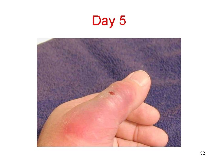 Day 5 32 