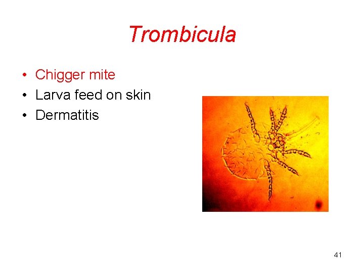 Trombicula • Chigger mite • Larva feed on skin • Dermatitis 41 