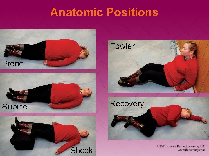 Anatomic Positions Fowler Prone Recovery Supine Shock 