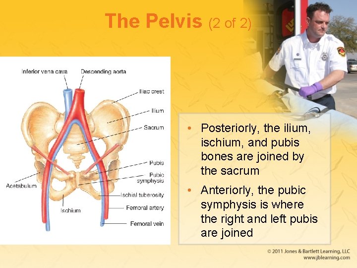 The Pelvis (2 of 2) • Posteriorly, the ilium, ischium, and pubis bones are