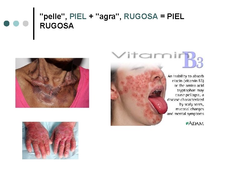 "pelle", PIEL + "agra", RUGOSA = PIEL RUGOSA 